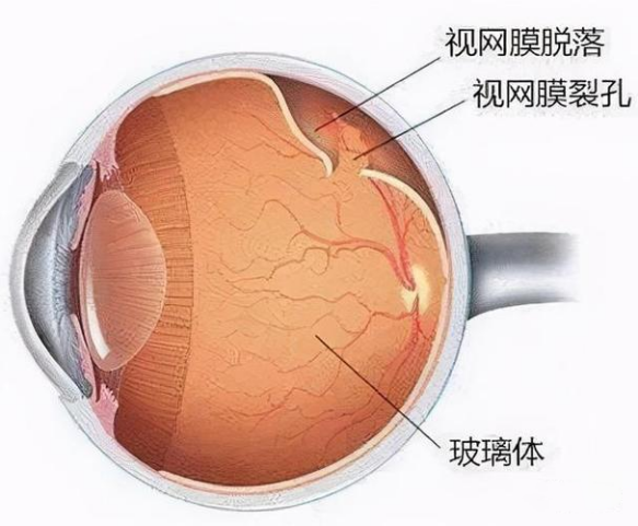 微信图片_20220221085432.png 微信图片_20220221085432.png