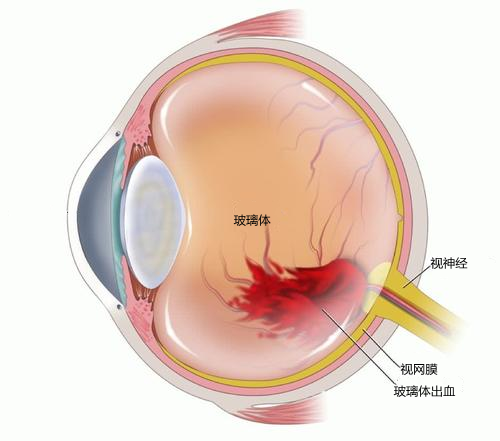 微信图片_20220221085435.png 微信图片_20220221085435.png