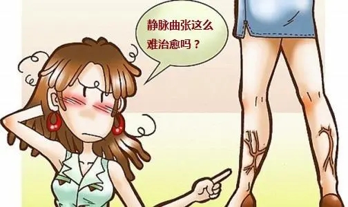 u=2618774587,683873739&fm=253&fmt=auto&app=138&f=JPEG.webp.jpg