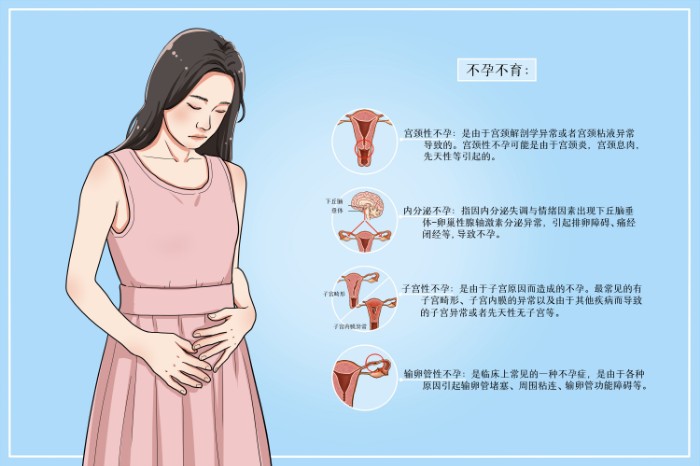 摄图网_401961514_女性不孕不育医疗插画（非企业商用）.jpg