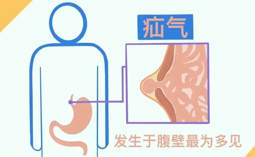 微信图片_20220429142117.jpg 微信图片_20220429142117.jpg