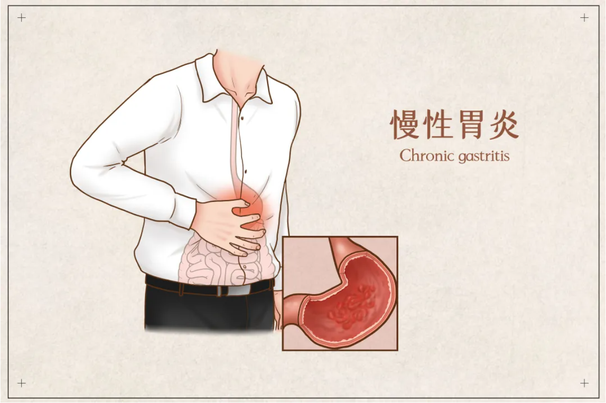 d5f95a1a3a6e8897936626390c4b3a0.png d5f95a1a3a6e8897936626390c4b3a0.png