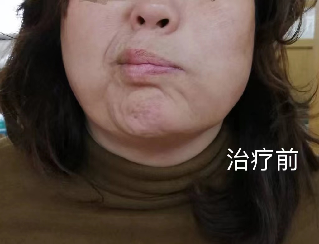 图片 1.png